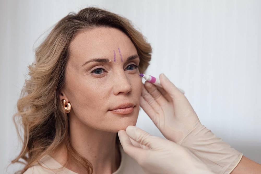 Ботулинотерапия «Full Face»